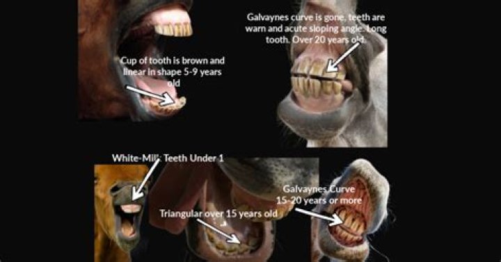 At what age do you get 32 teeth?
