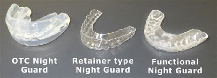 Can a night guard change your face shape?