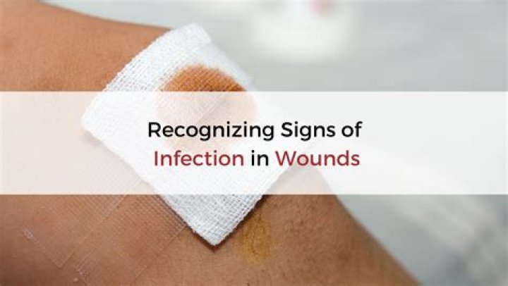 Can an infected wound make you sick?