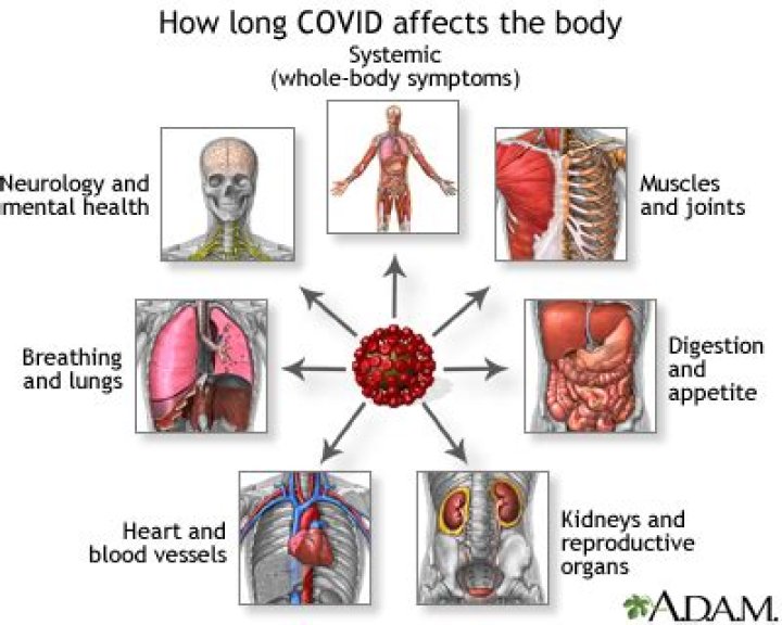 Can Covid affect epilepsy?