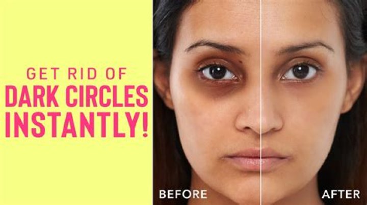 Can drinking water help dark circles?