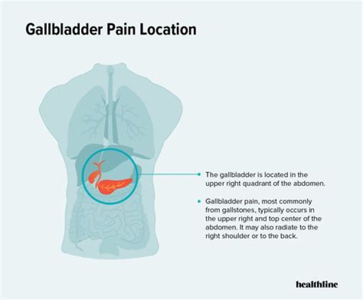Can gallbladder pain last for days?