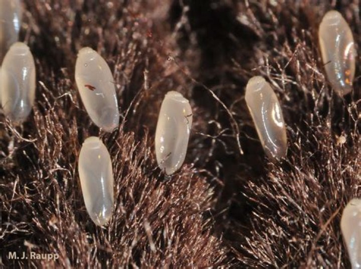 Can lice eggs hatch off the head?