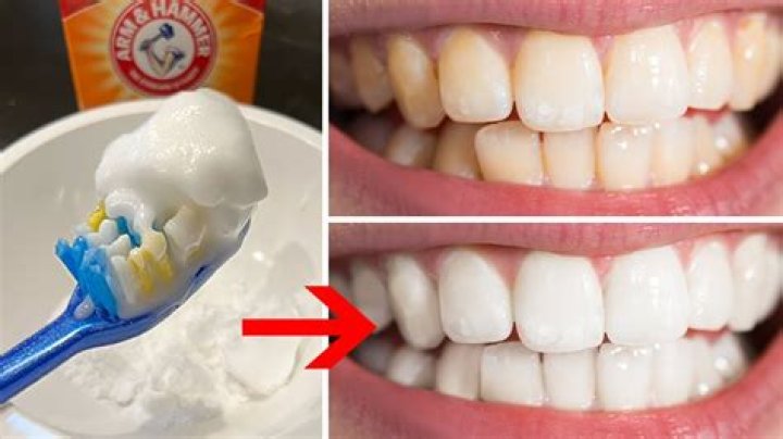 Can salt whiten the teeth?