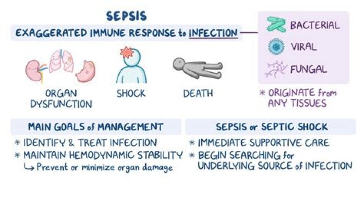 Can sepsis keep coming back?