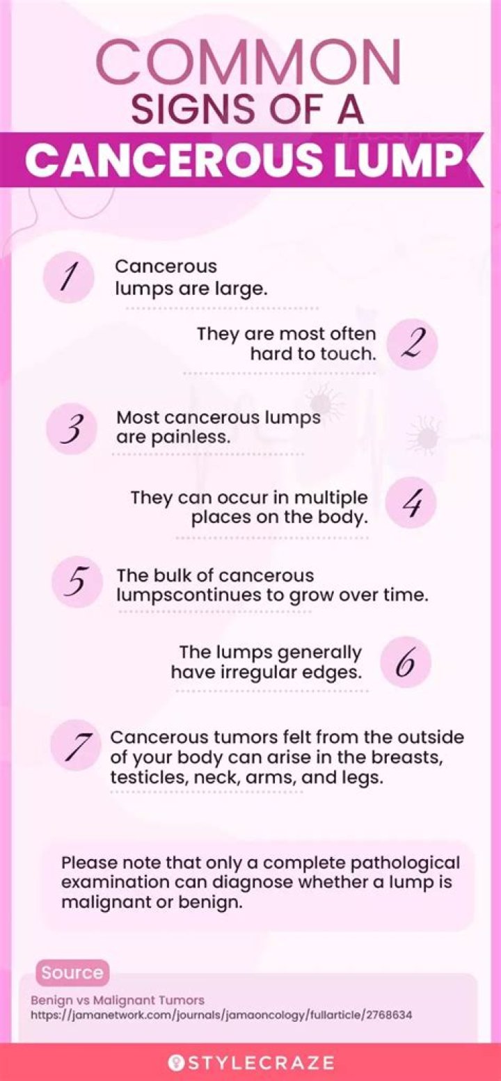 Can soft lump be cancerous?