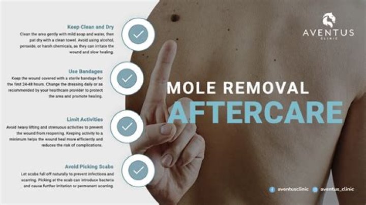 Can you get a mole overnight?