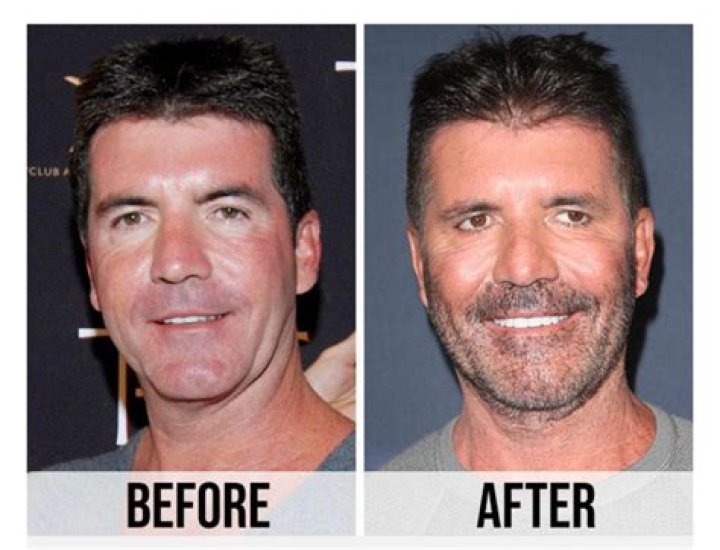 Did Dr. Dubrow have Botox?