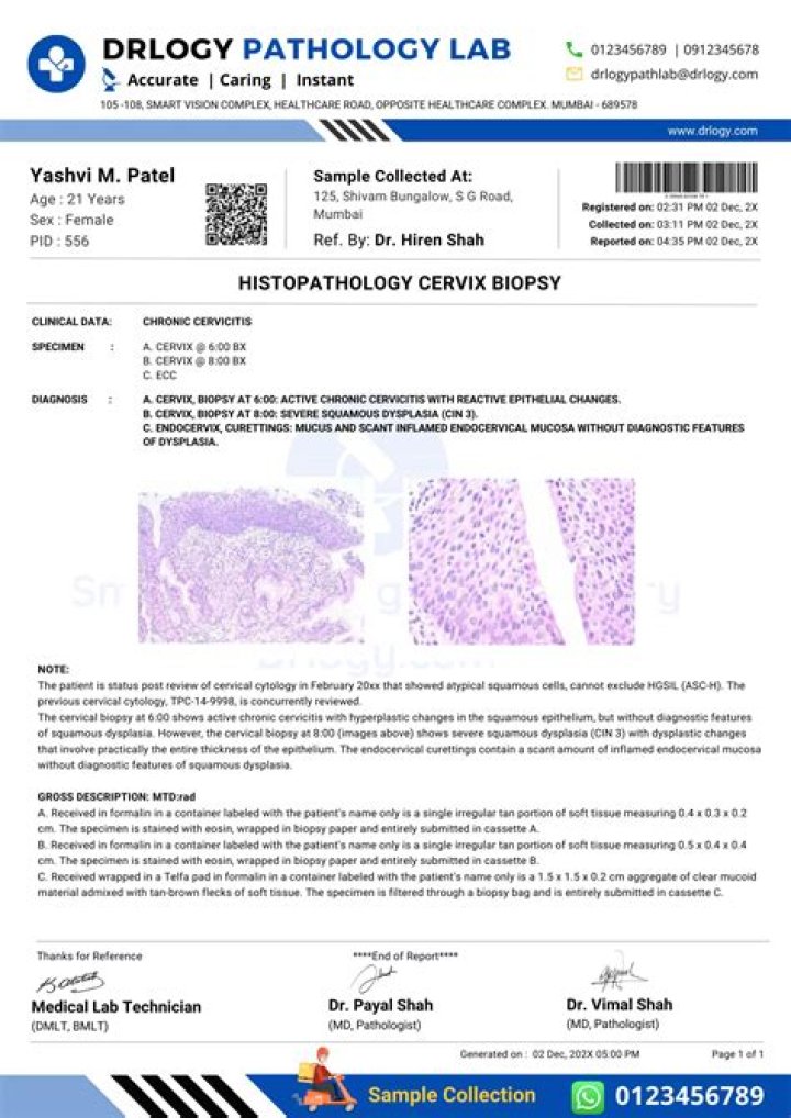 Do doctors call with negative biopsy results?