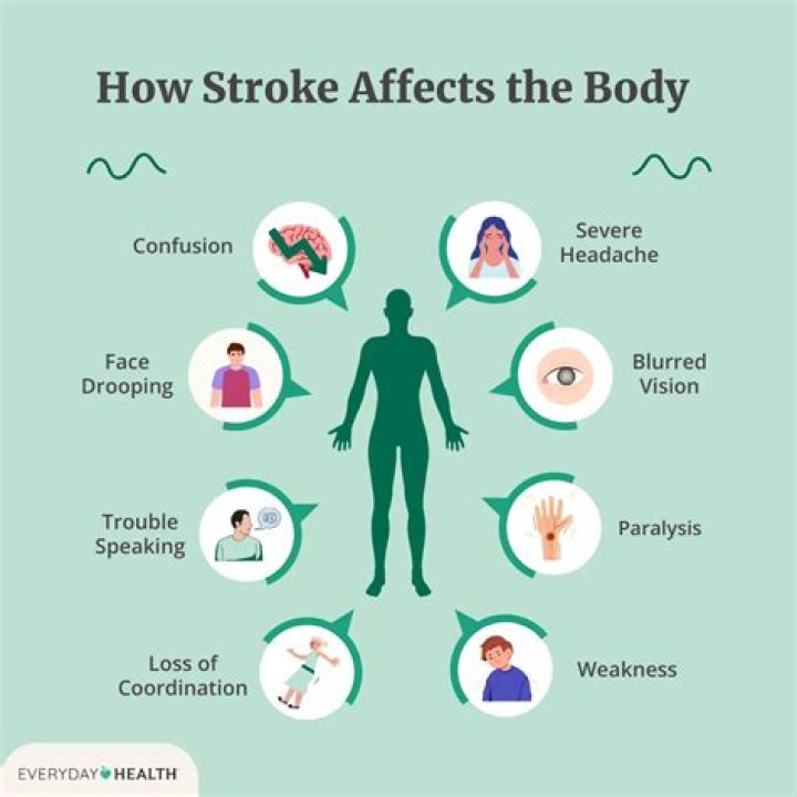 Do emotions come back after a stroke?
