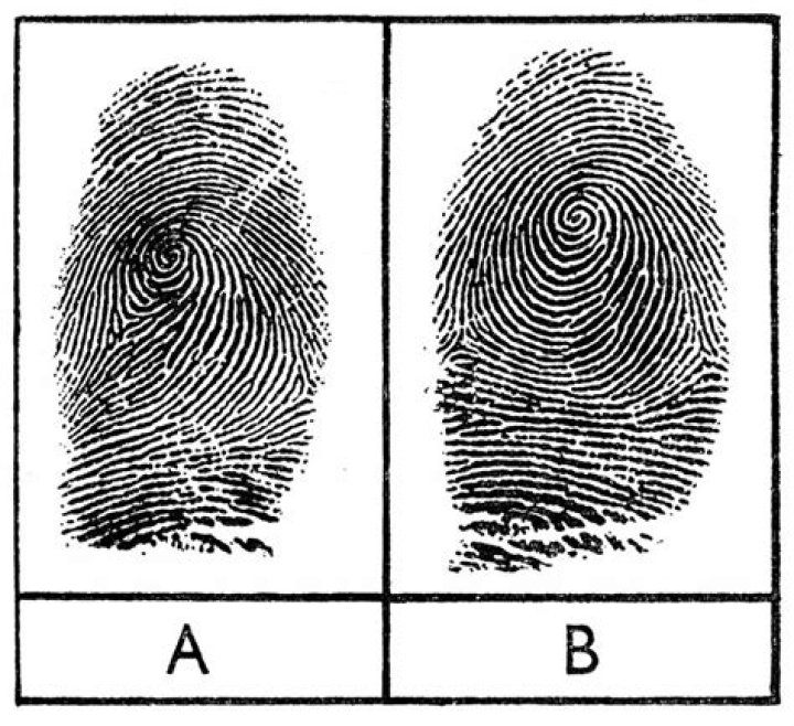 Do identical twins have fingerprints?