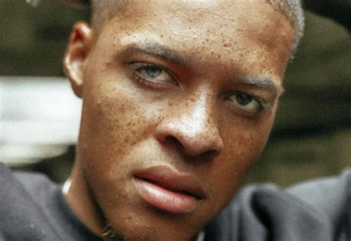 Do Irish have freckles?
