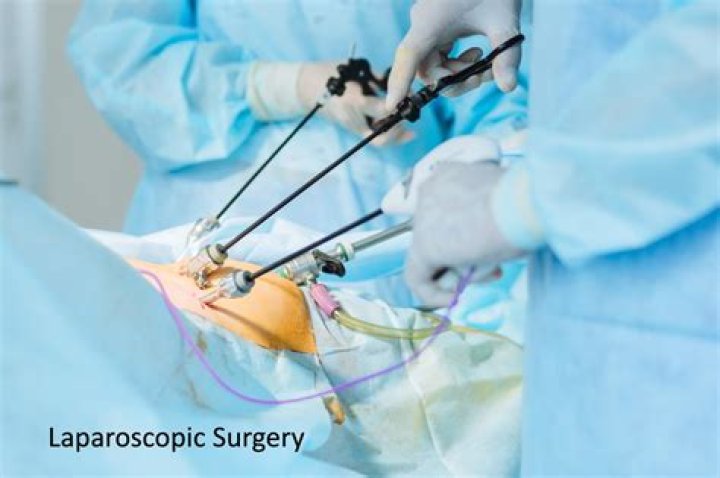 Do they cut you open for biopsy?