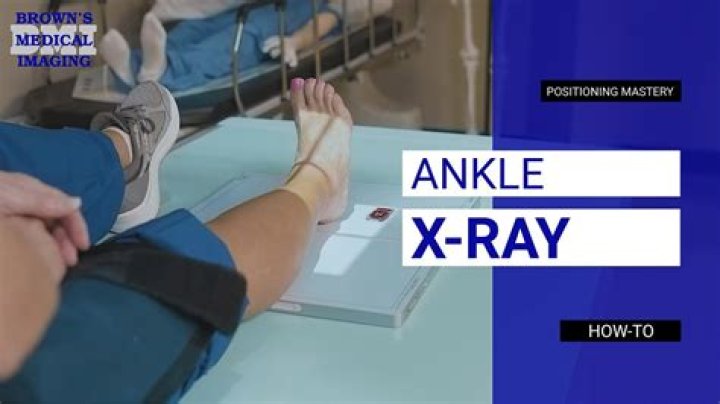 Do they xray mail?