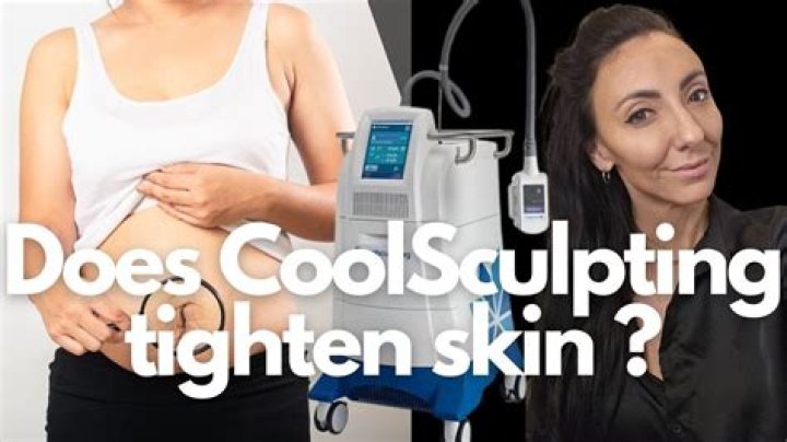 Does CoolSculpting tighten skin?