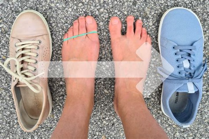 Does Debbie get her toes cut off?