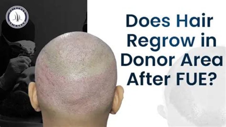 Does hair regrow?