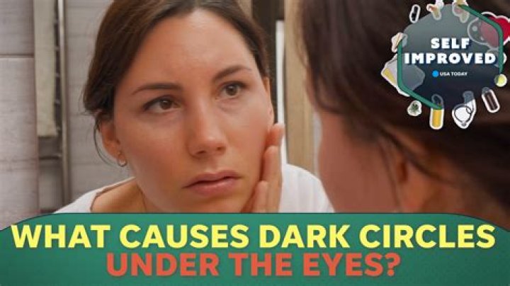 Does honey help dark circles?