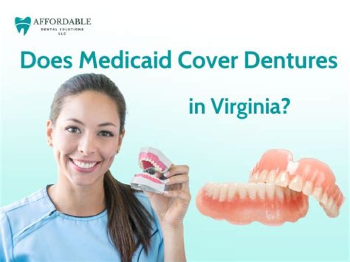 Does Medicaid cover visitors?