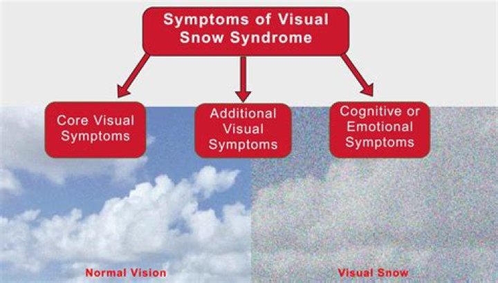 Does serotonin syndrome go away naturally?