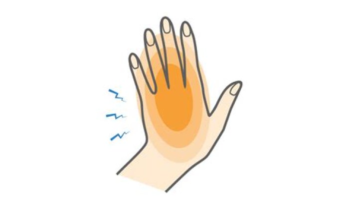 How bad is a hand contusion?