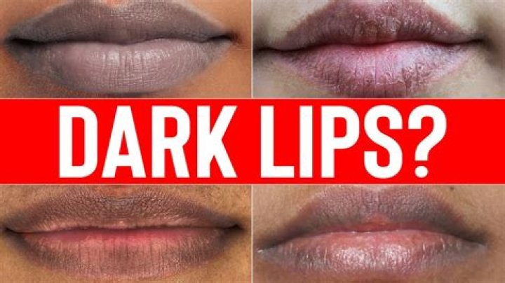 How can I keep my lips from turning black?