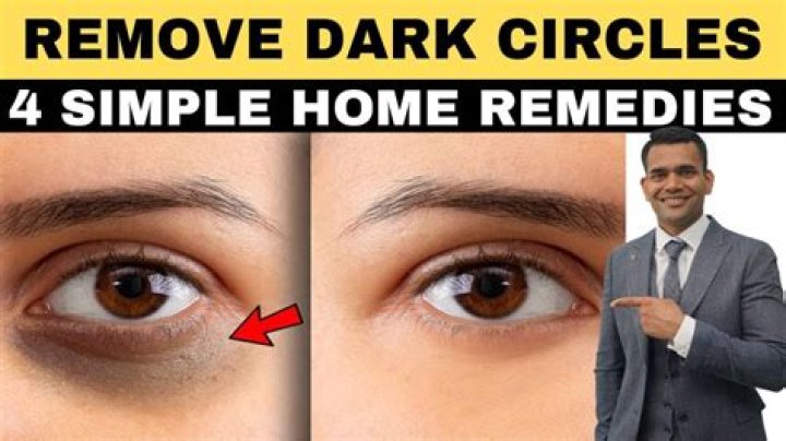 How can I remove my face darkness?