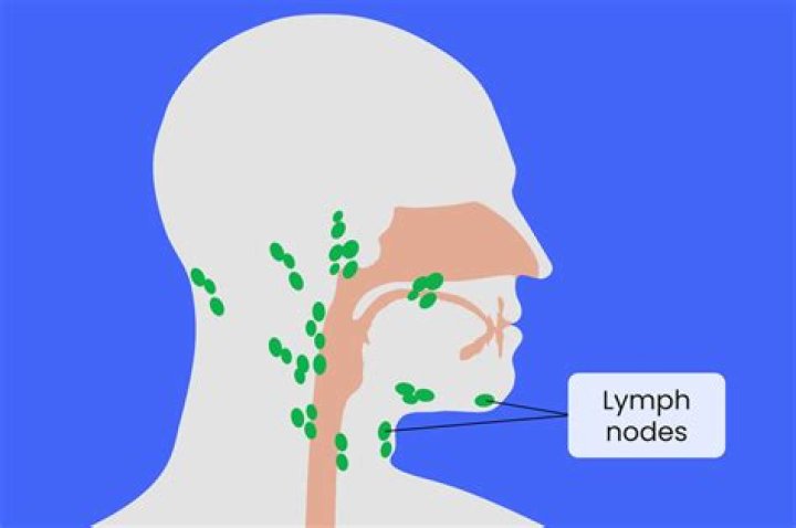 How do I check my lymph nodes?