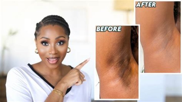How do I lighten my armpits?