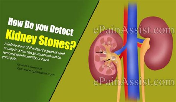 How do you detect kidney stones?