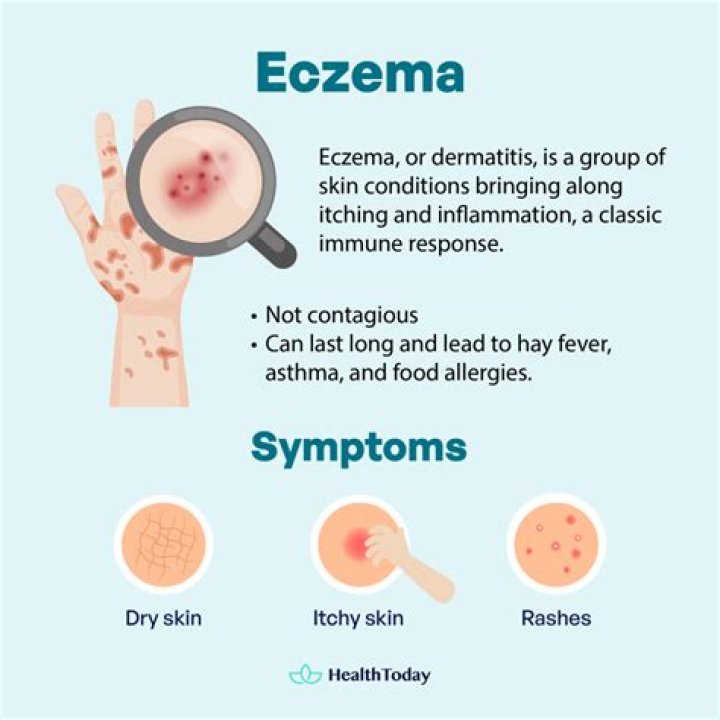 How does Eczema affect the immune system?