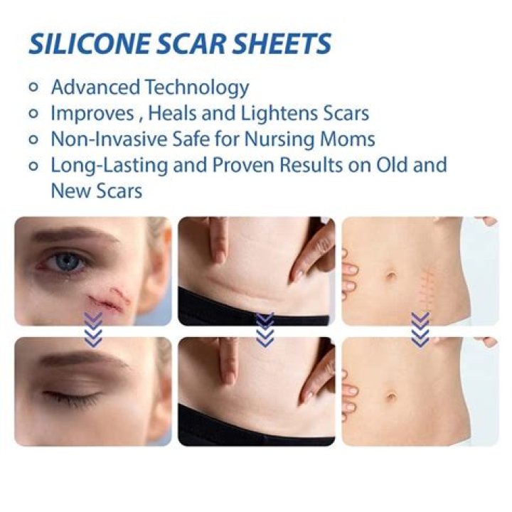 How long can you store silicone?