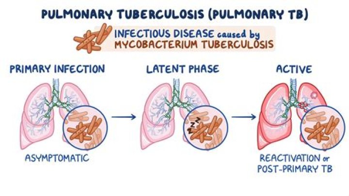 How long do tuberculosis shots last?
