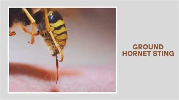 How long does a ground hornet sting last?