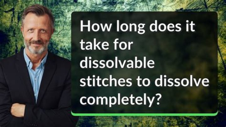 How long does it take to dissolve an estate?
