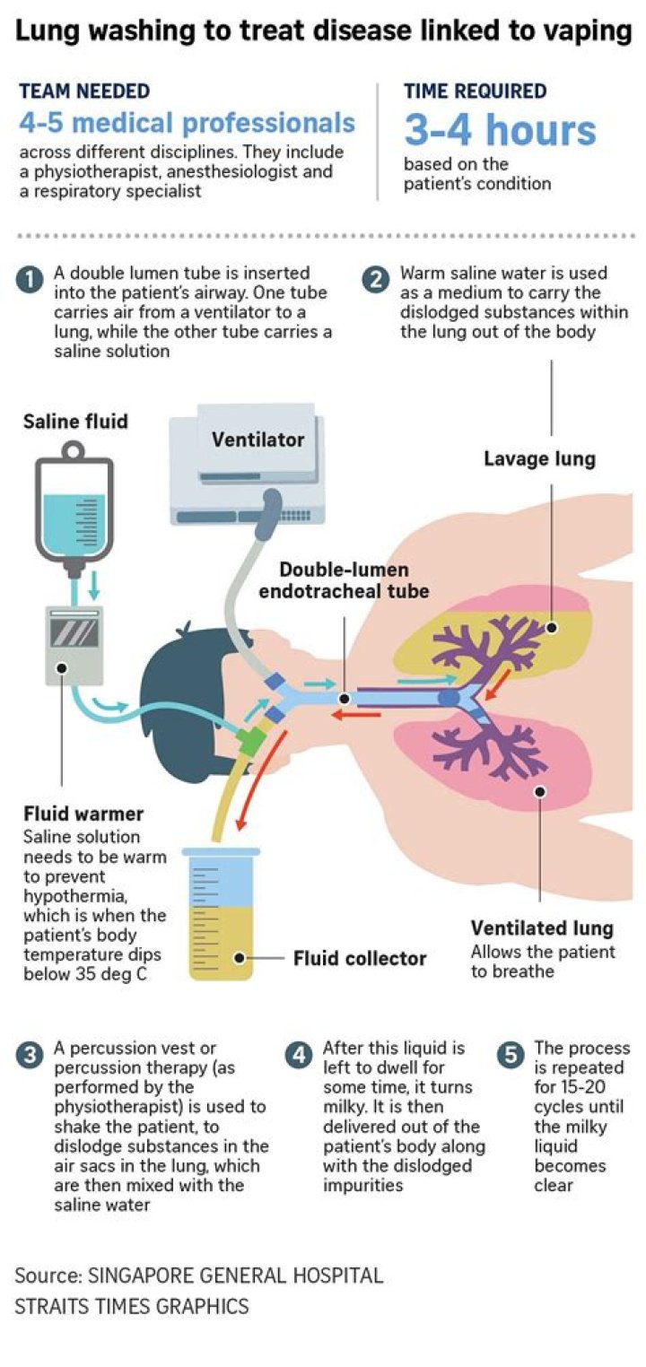How long does lung washing take?