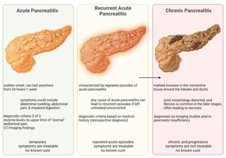 How long is pancreatitis undetected?