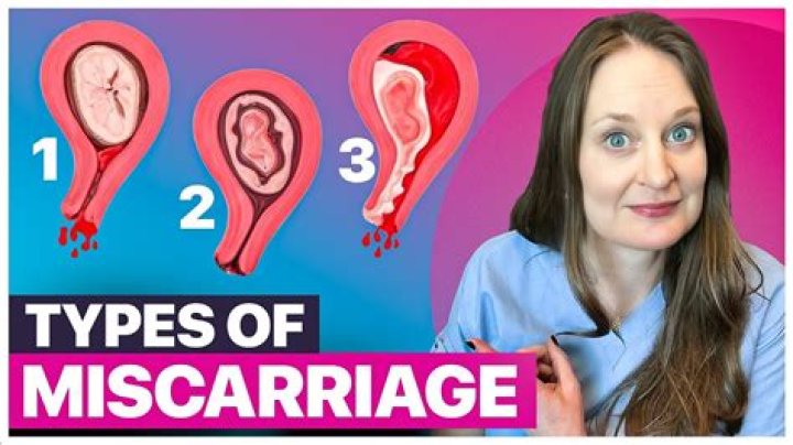 How many miscarriages did Alanis Morissette have?