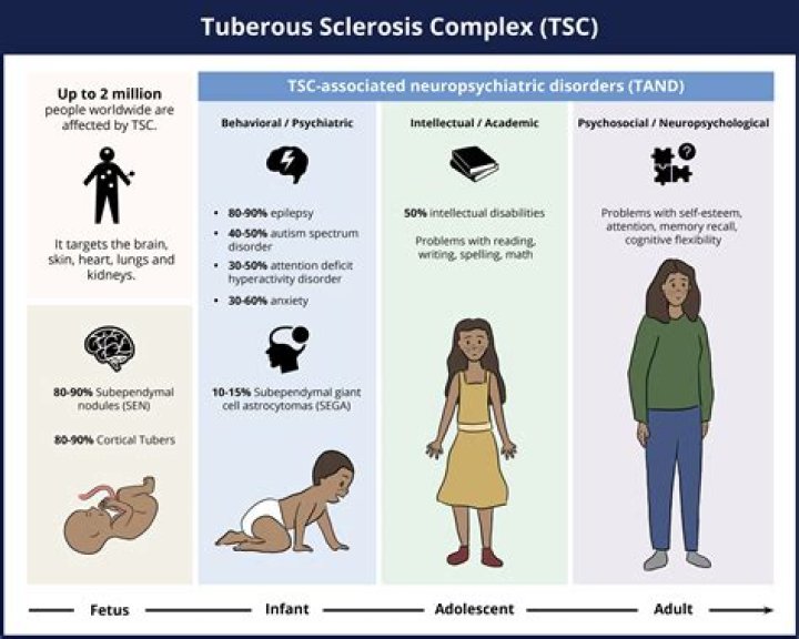 How many people get tuberous sclerosis each year?