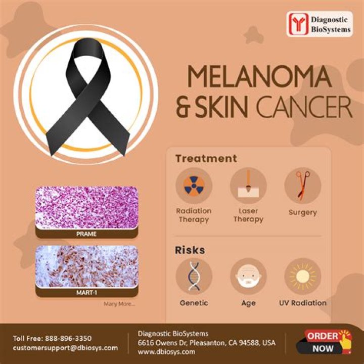 How often are dermatologists wrong about melanoma?