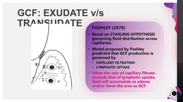 Is GCF an exudate or transudate?