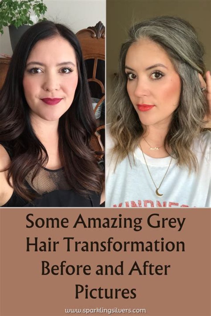 Is GREY hair normal at 20?