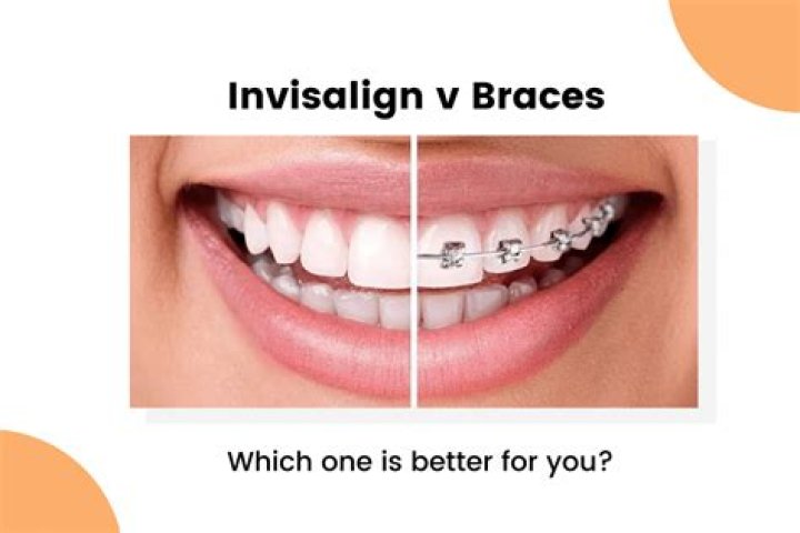 Is Invisalign more expensive than braces?