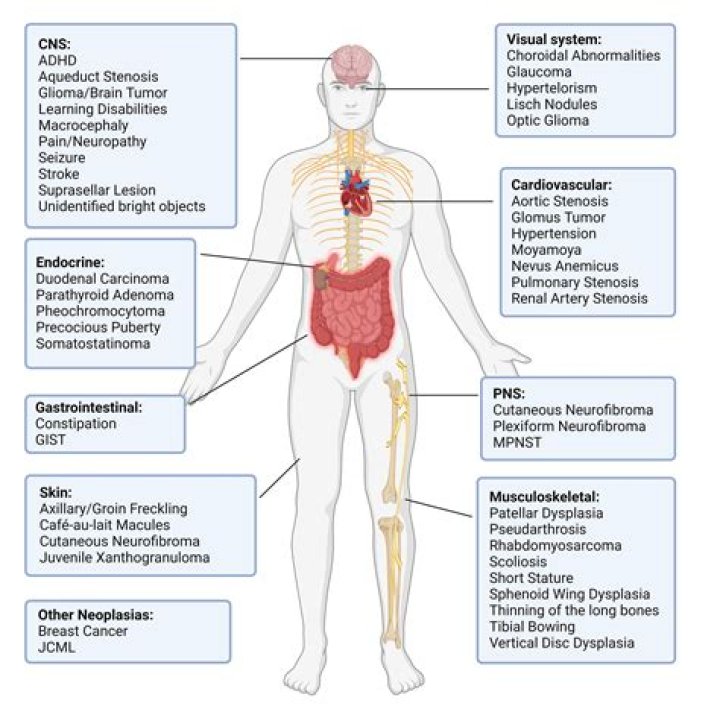Is NF1 a neurological disorder?