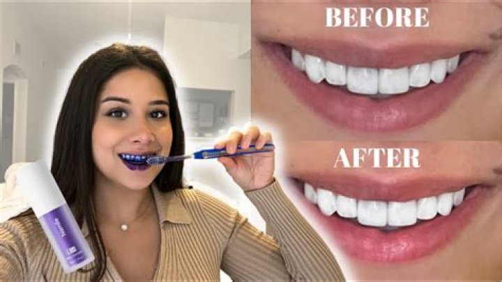 Is salt can make teeth white?