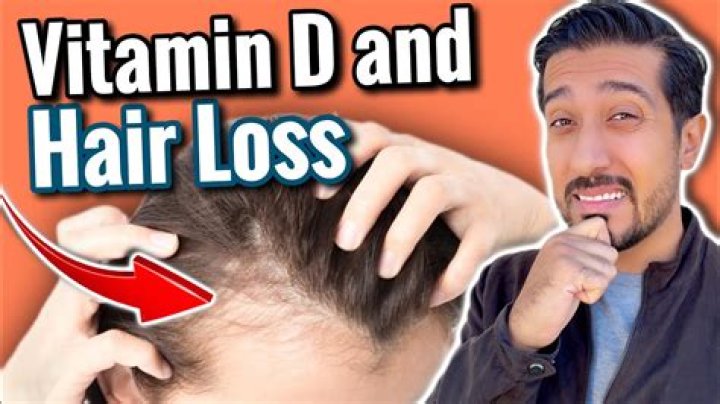 Is vitamin D baldness reversible?