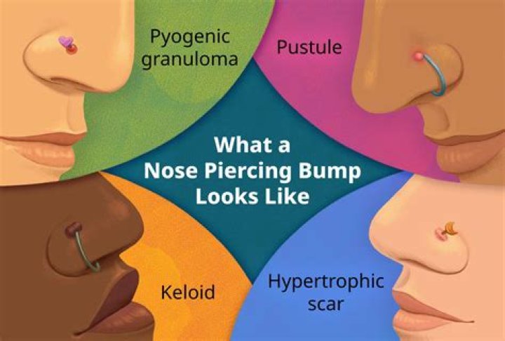 Should I let my piercing breathe?