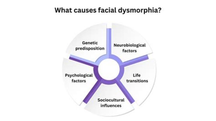 What causes facial dysmorphia?