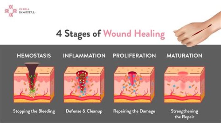 What causes slow healing after surgery?