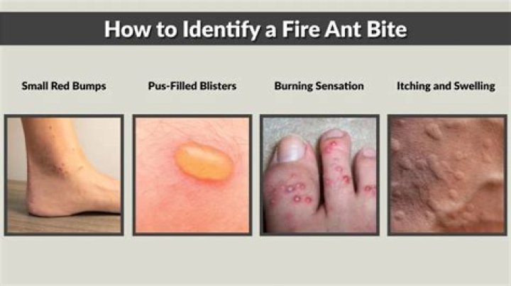 What does a fire ant bite look like?